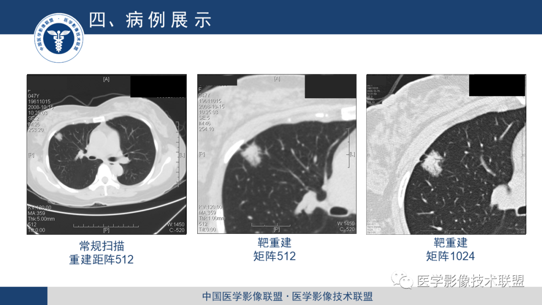 影像PPT - 【PPT】靶重建技术综述-9