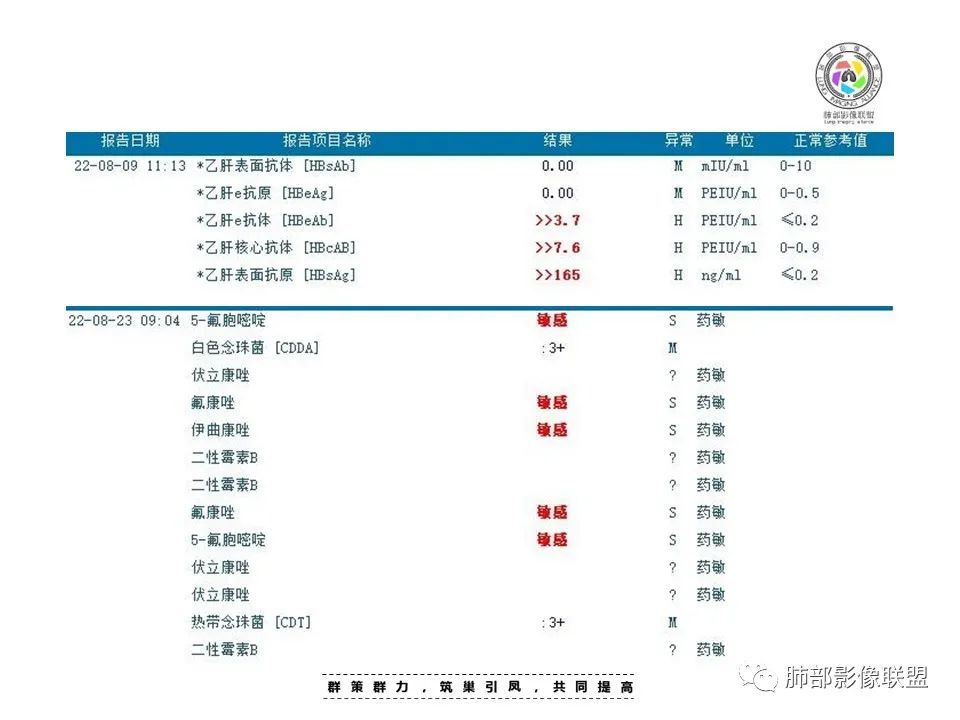 影像PPT - 【病例】HIV卡波西肉瘤1例肺部影像表现-4