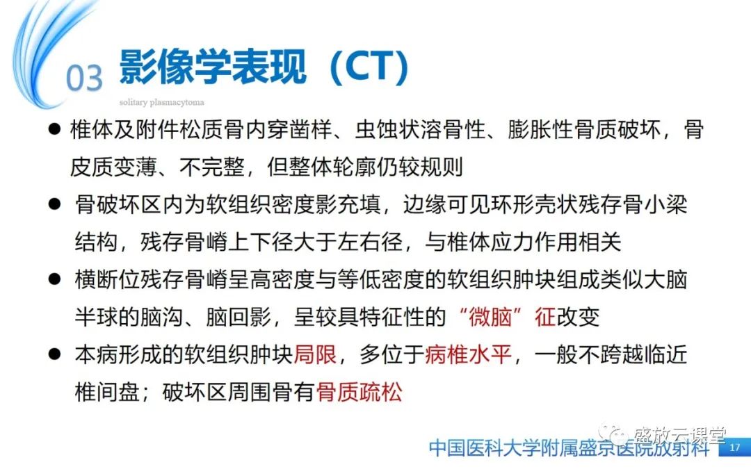 影像PPT - 【PPT】孤立性浆细胞瘤-16