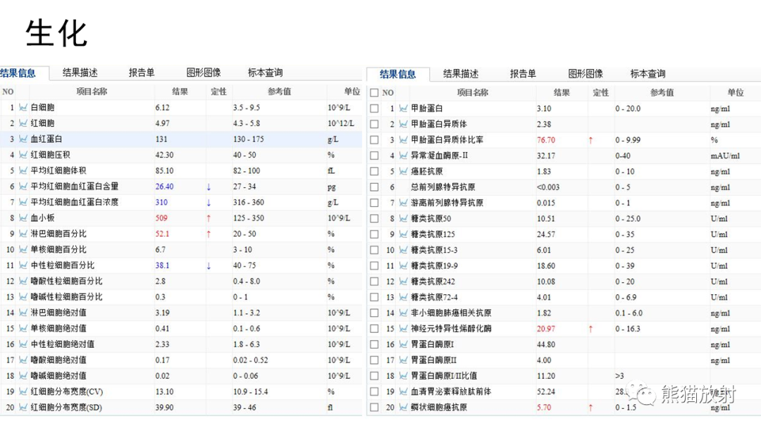 影像PPT - 【病例】前纵隔畸胎瘤2例CT影像-9