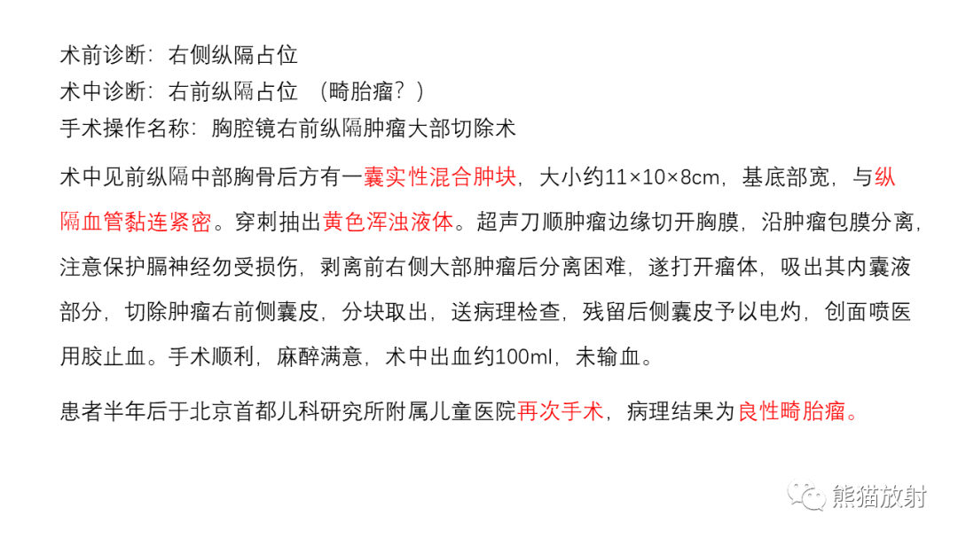 影像PPT - 【病例】前纵隔畸胎瘤2例CT影像-19