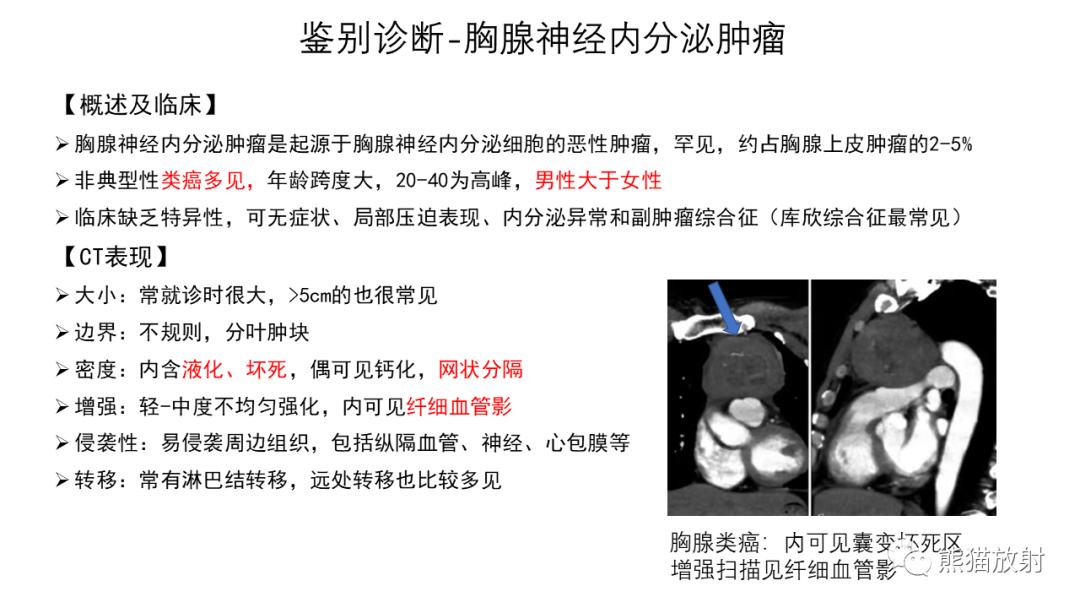 影像PPT - 【病例】前纵隔畸胎瘤2例CT影像-30