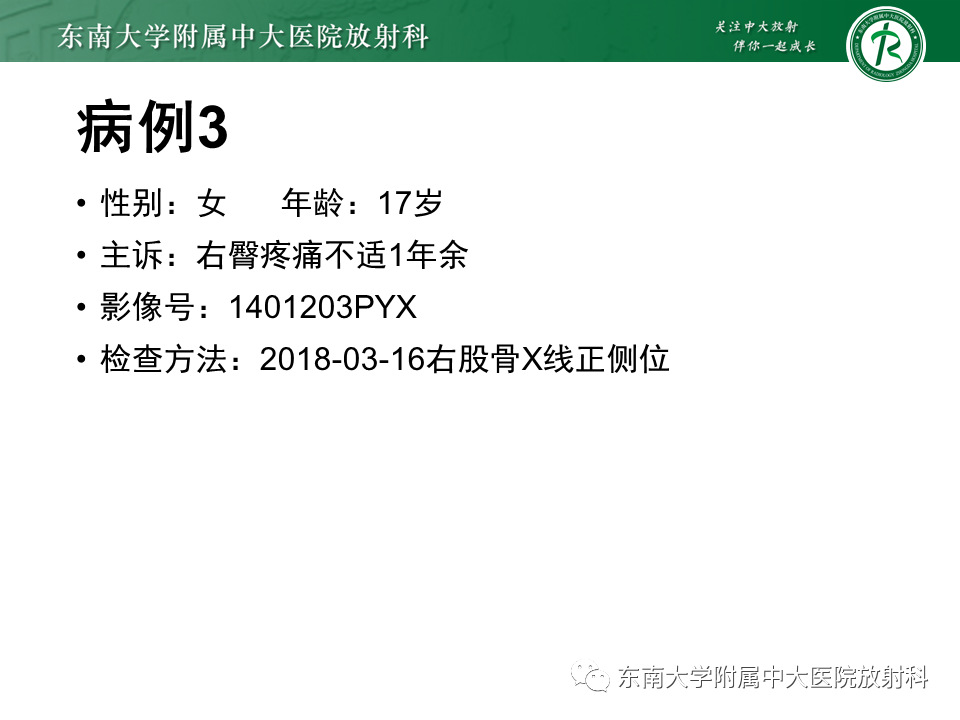 影像PPT - 【PPT】骨纤维异常增殖症-17