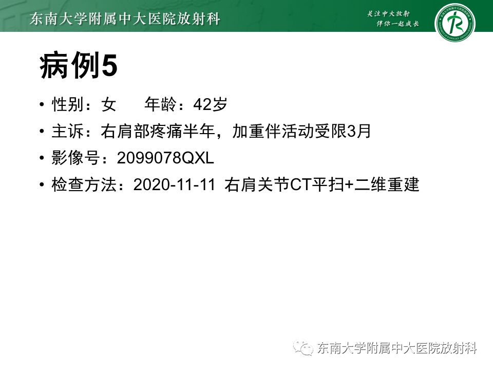 影像PPT - 【PPT】骨纤维异常增殖症-23