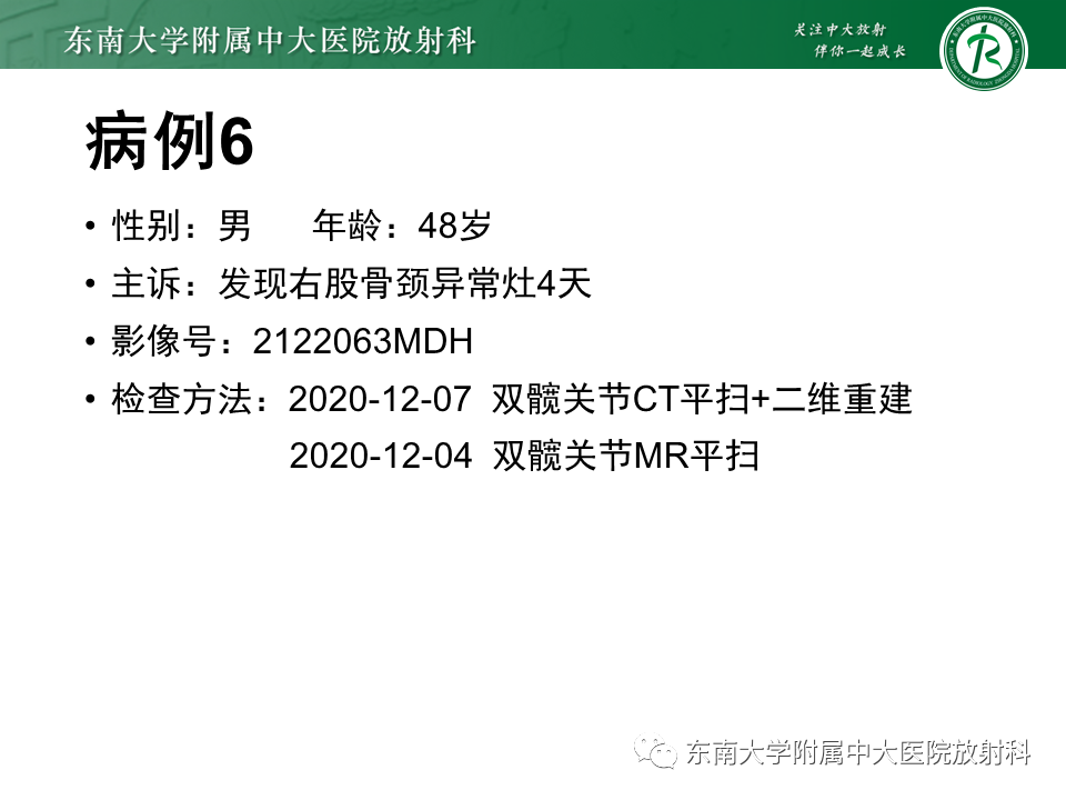 影像PPT - 【PPT】骨纤维异常增殖症-27