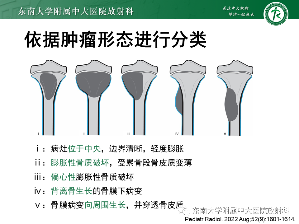 影像PPT - 【PPT】骨纤维异常增殖症-31