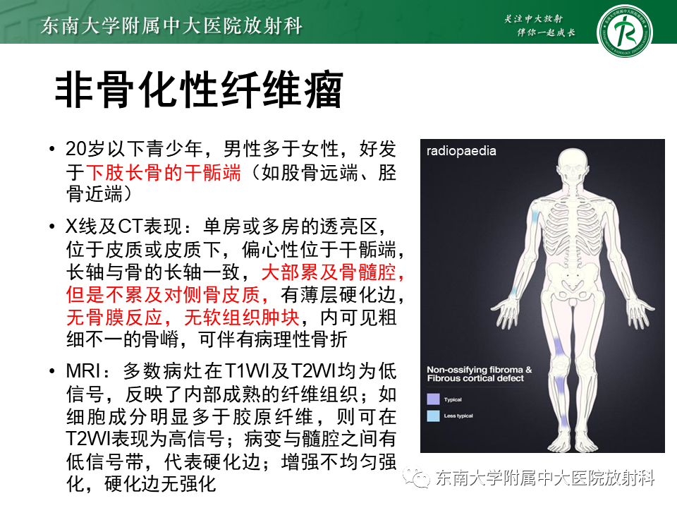 影像PPT - 【PPT】骨纤维异常增殖症-40