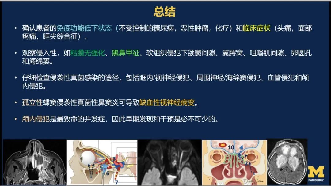 影像PPT - 【PPT】致命的真菌：头颈部侵入性真菌感染(双语)-20