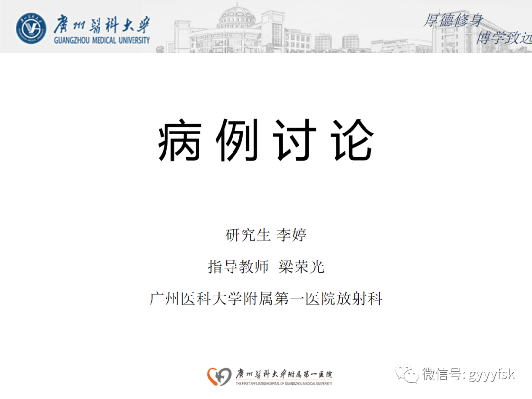 影像PPT - 【病例】正中弓状韧带压迫综合征1例CT影像-1