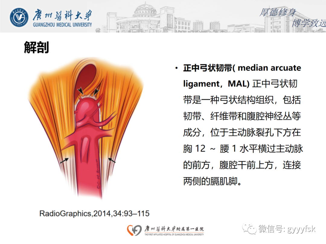 影像PPT - 【病例】正中弓状韧带压迫综合征1例CT影像-6