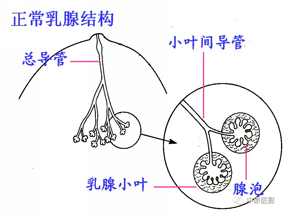影像PPT - 【PPT】乳腺导管内乳头状瘤MRI表现-5
