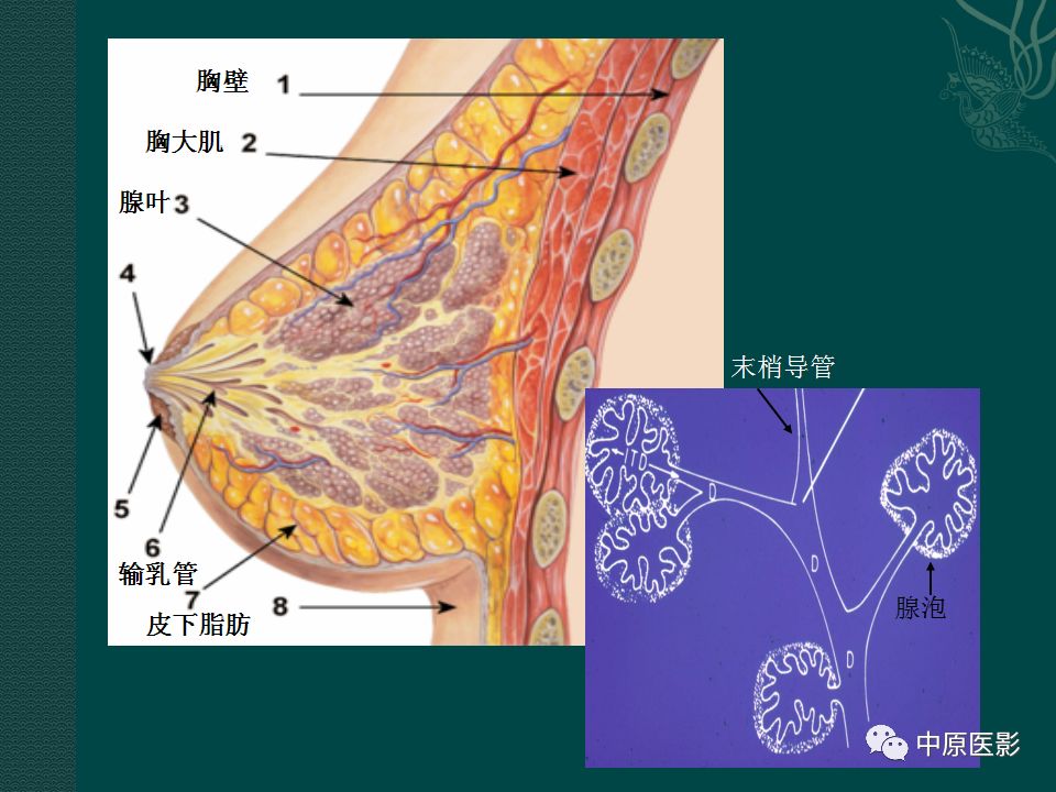 影像PPT - 【PPT】乳腺导管内乳头状瘤MRI表现-3