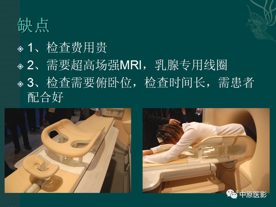 影像PPT - 【PPT】乳腺导管内乳头状瘤MRI表现-7