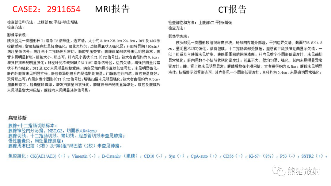 影像PPT - 【病例】胰腺神经内分泌肿瘤2例CT及MR影像-17