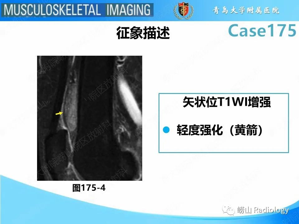 影像PPT - 【PPT】局灶性结节性滑膜炎-28