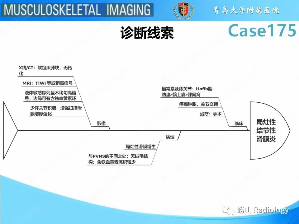 影像PPT - 【PPT】局灶性结节性滑膜炎-29