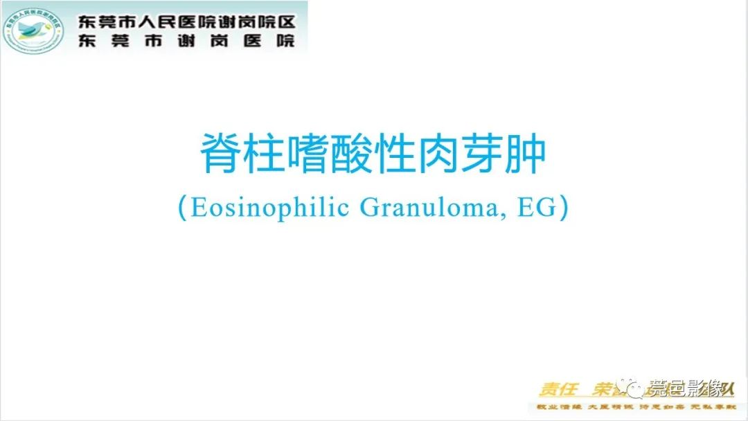 影像PPT - 【PPT】脊柱嗜酸性肉芽肿影像表现-14