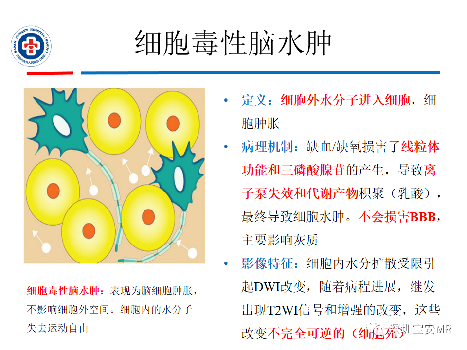 影像PPT - 【PPT】中毒性和代谢性脑病的影像模式-6