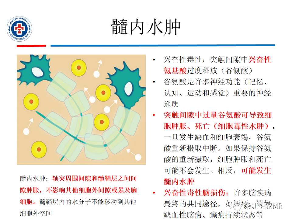 影像PPT - 【PPT】中毒性和代谢性脑病的影像模式-8
