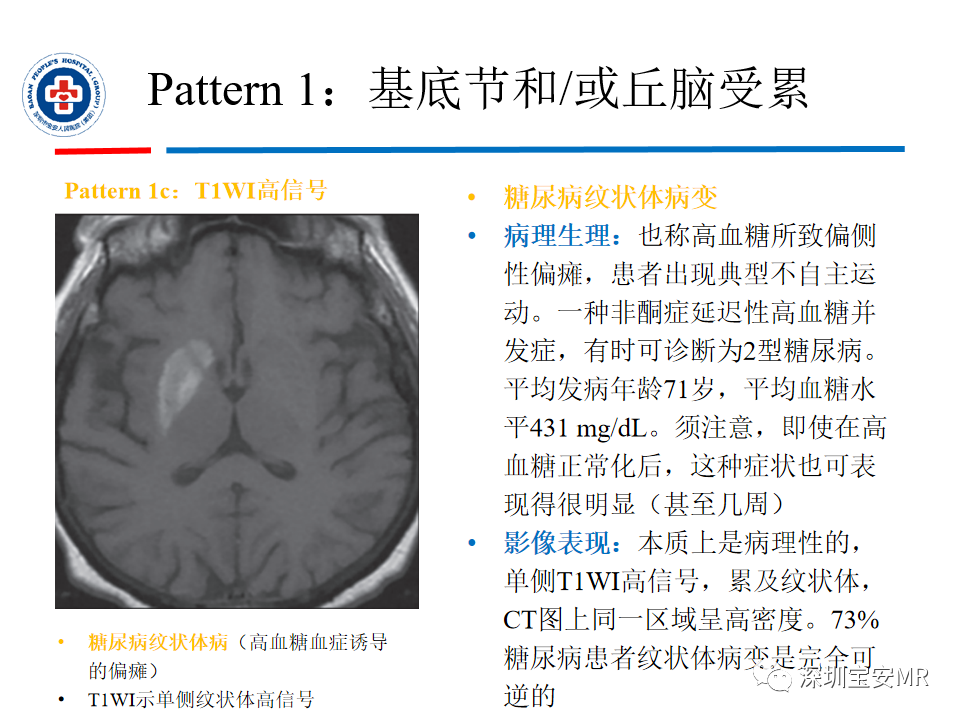 影像PPT - 【PPT】中毒性和代谢性脑病的影像模式-21