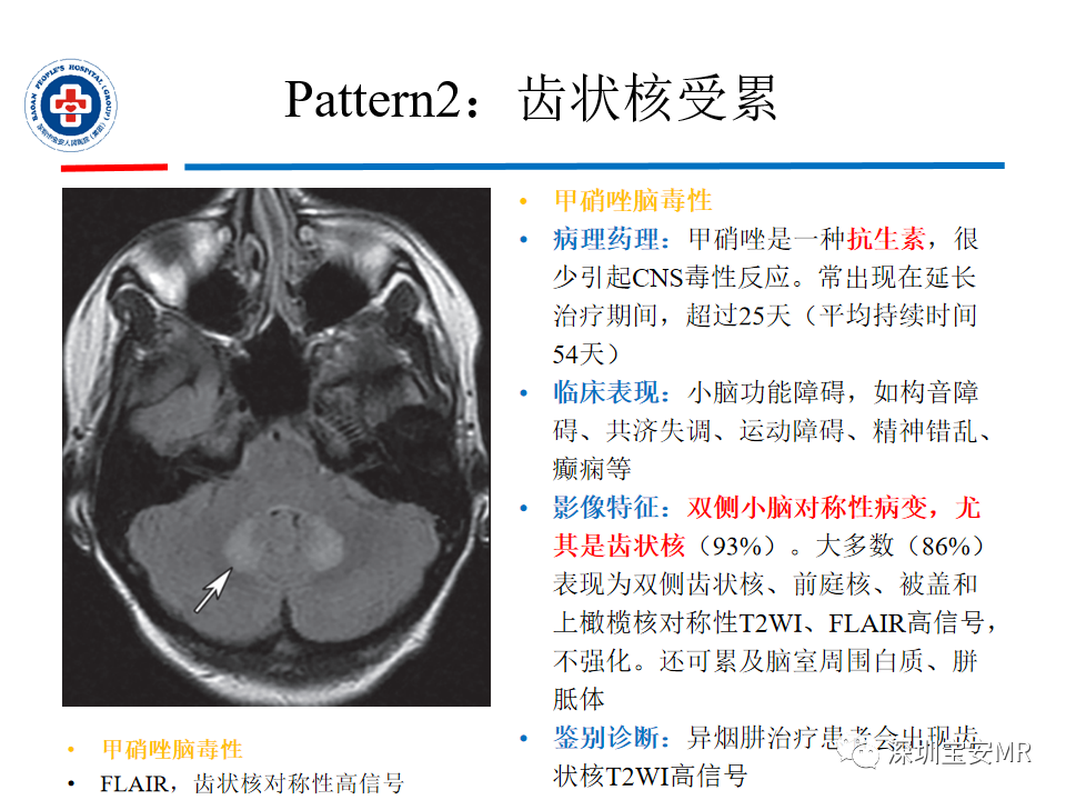 影像PPT - 【PPT】中毒性和代谢性脑病的影像模式-24