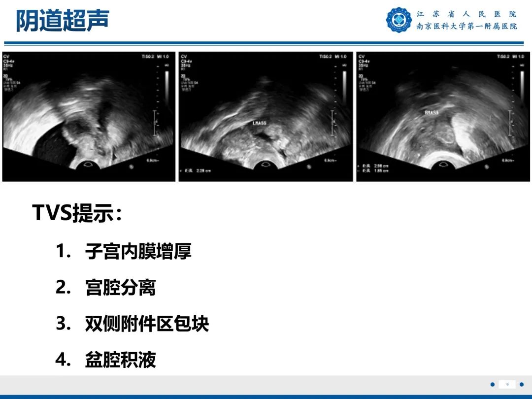 影像PPT - 【PPT】输卵管结核-7