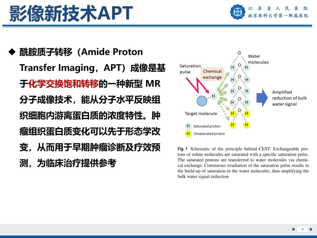 影像PPT - 【PPT】输卵管结核-31