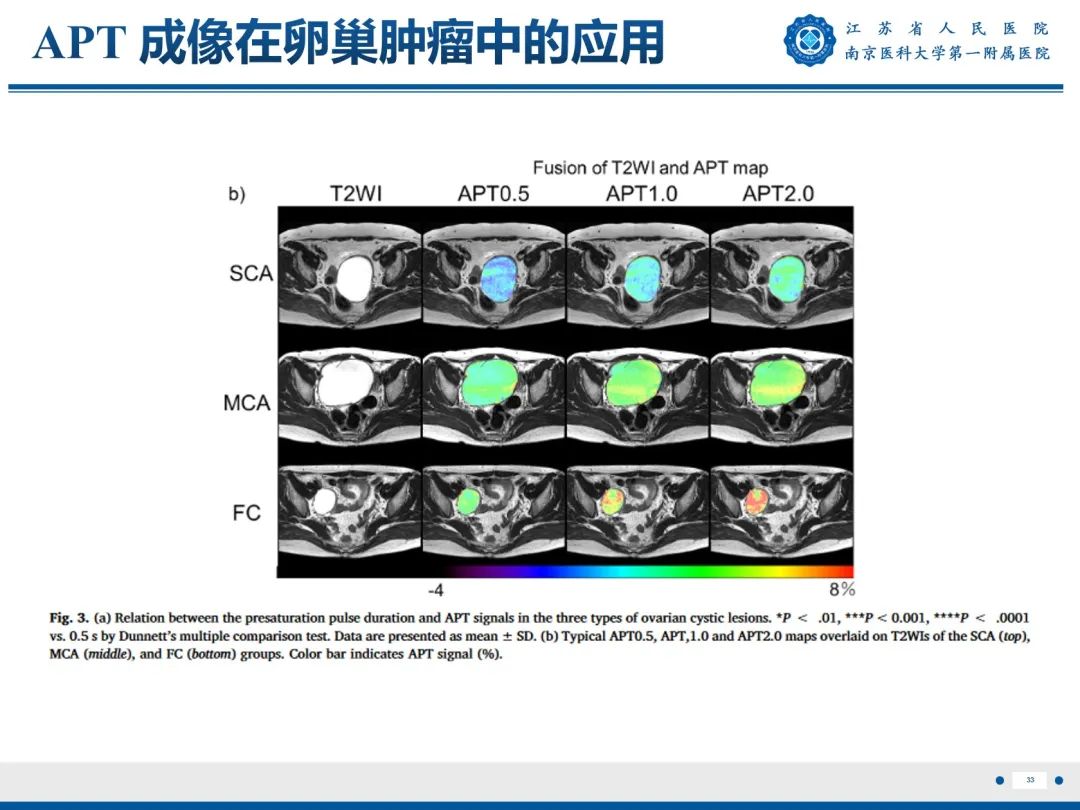影像PPT - 【PPT】输卵管结核-34