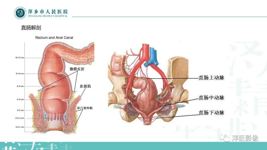 影像PPT - 【PPT】直肠癌MR分期-2