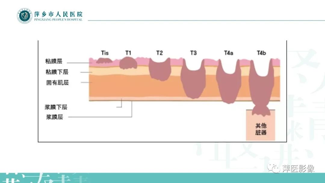 影像PPT - 【PPT】直肠癌MR分期-11