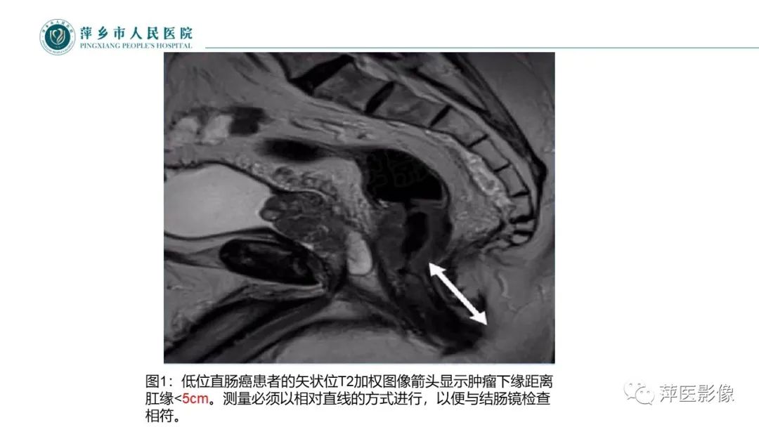 影像PPT - 【PPT】直肠癌MR分期-27