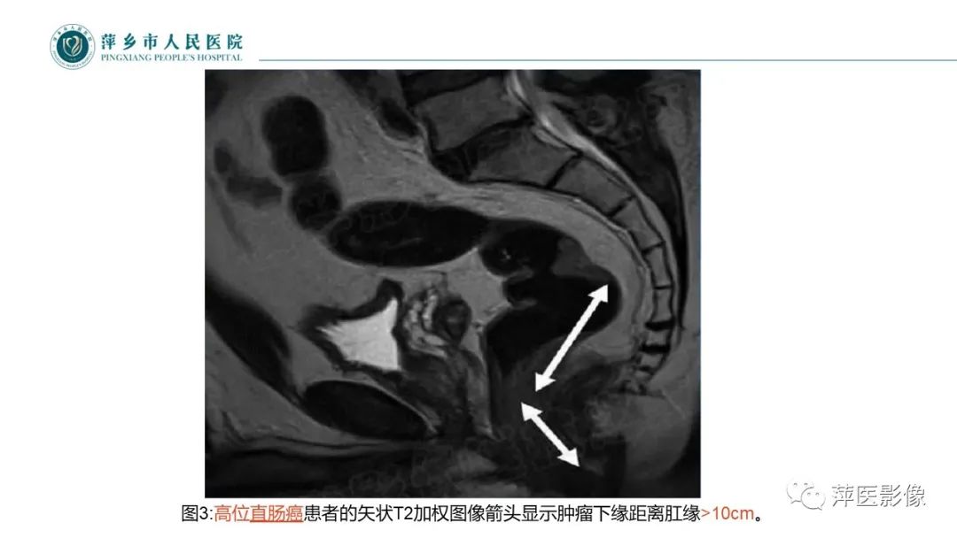 影像PPT - 【PPT】直肠癌MR分期-29