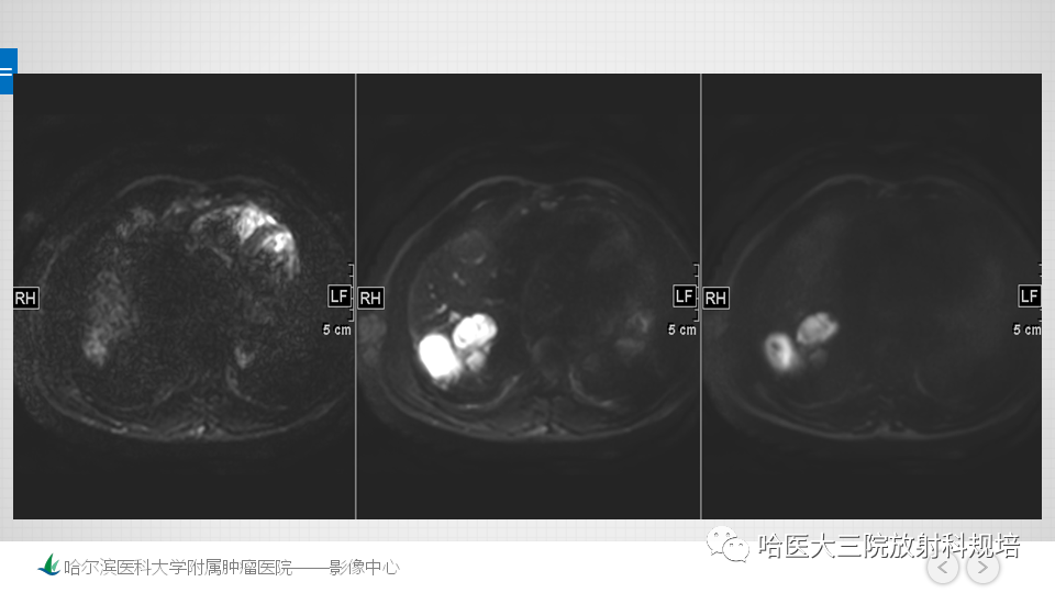 影像PPT - 【PPT】肝脏扫描规范及常见问题-16