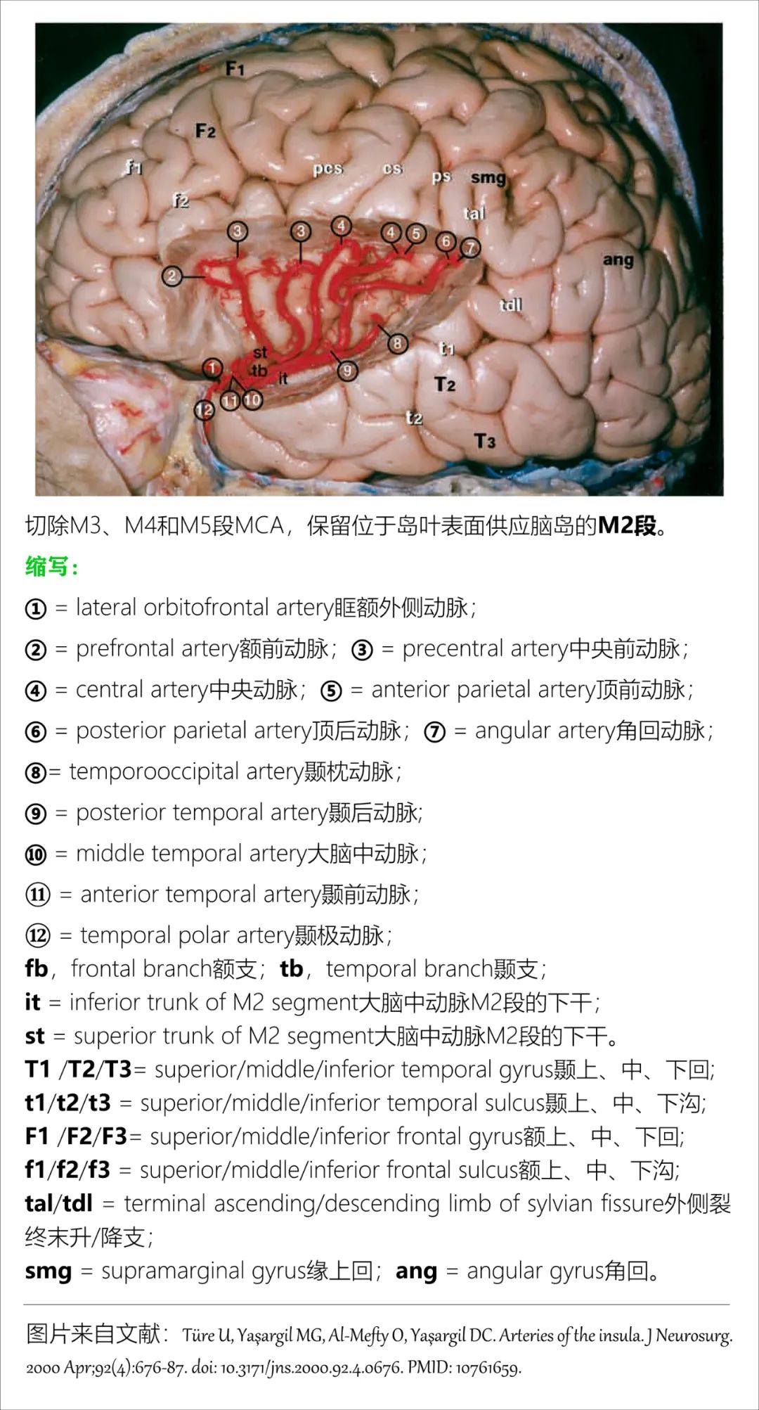 影像PPT - 大脑中动脉解剖-10 影像PPT - 大脑中动脉解剖-10