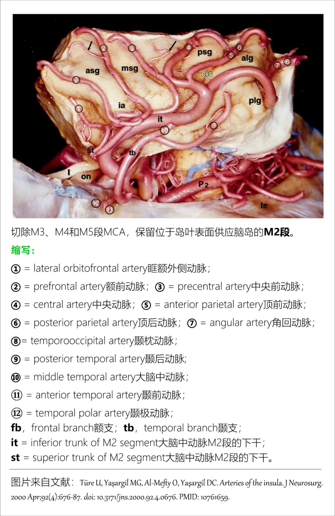 影像PPT - 大脑中动脉解剖-11 影像PPT - 大脑中动脉解剖-11
