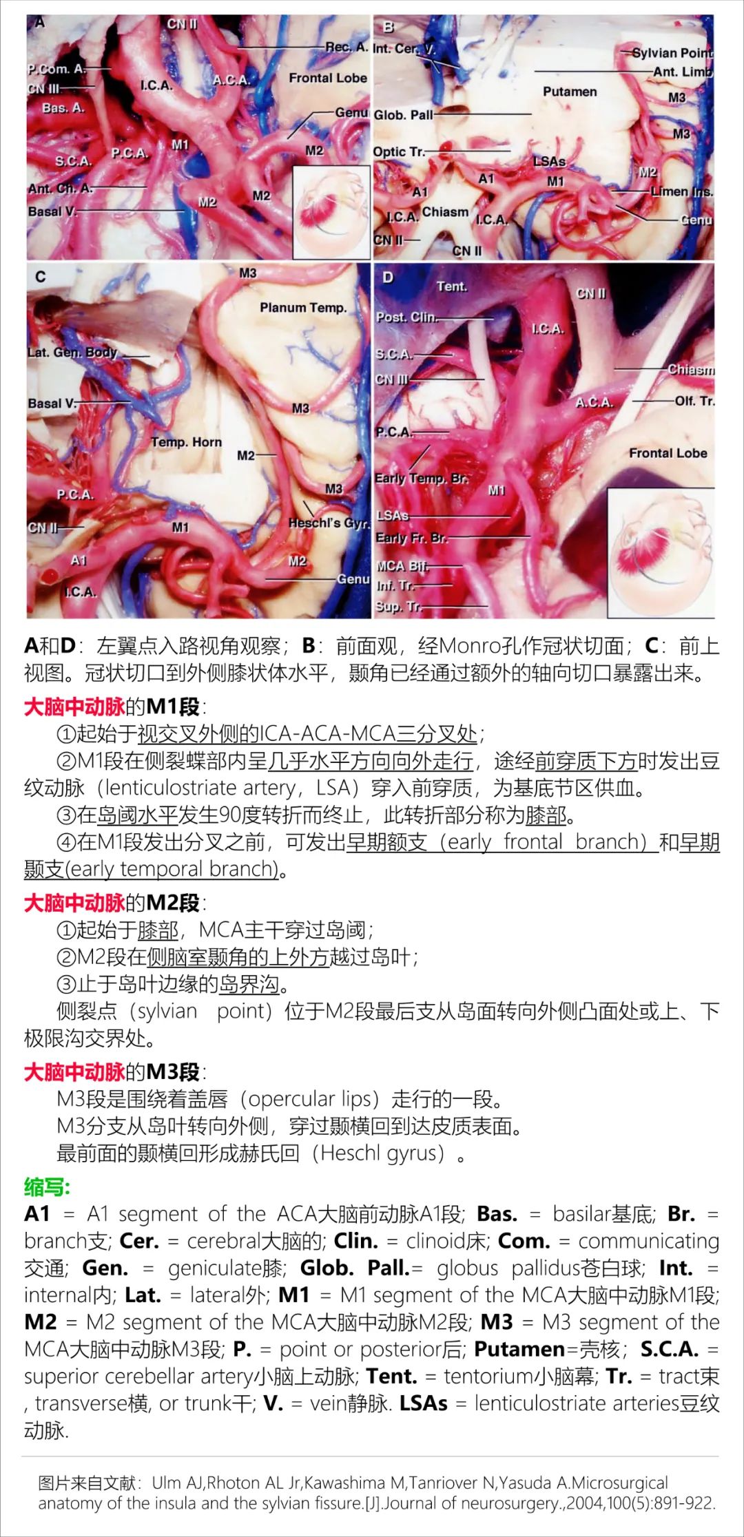 影像PPT - 大脑中动脉解剖-16 影像PPT - 大脑中动脉解剖-16