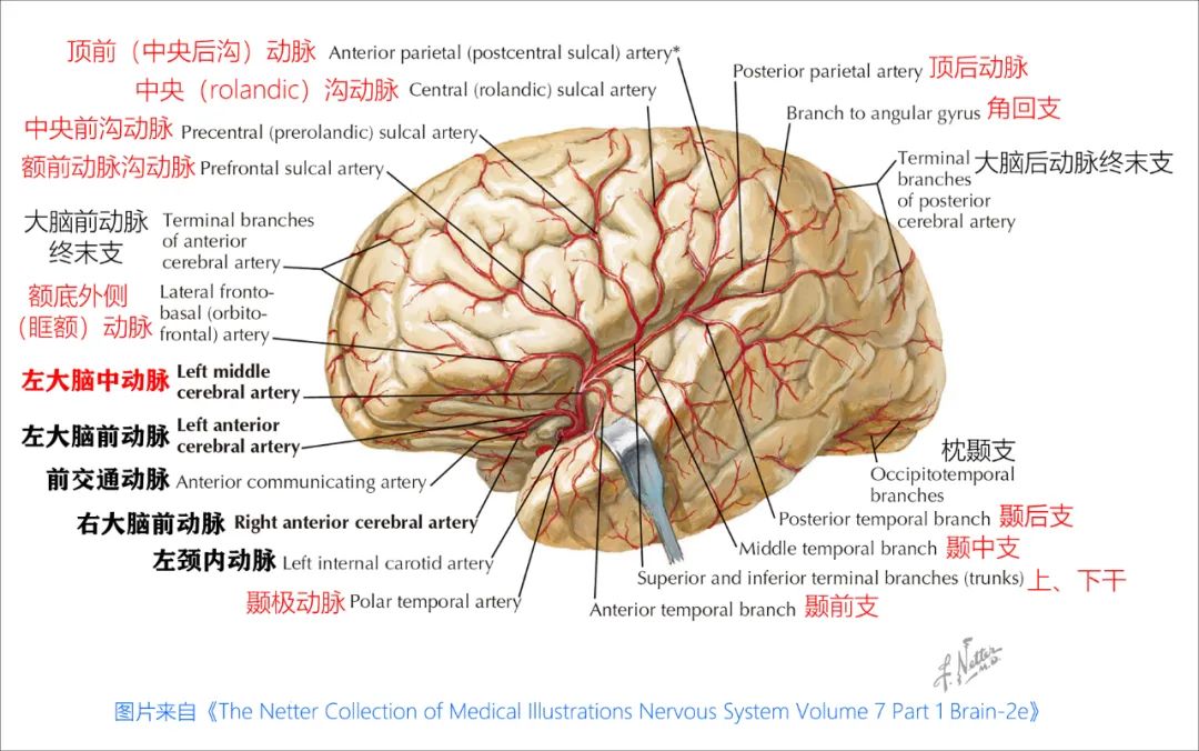 影像PPT - 大脑中动脉解剖-17 影像PPT - 大脑中动脉解剖-17