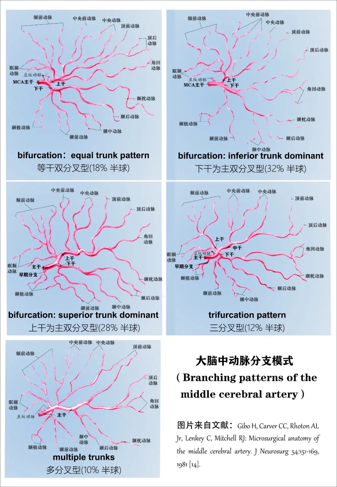 影像PPT - 大脑中动脉解剖-21 影像PPT - 大脑中动脉解剖-21