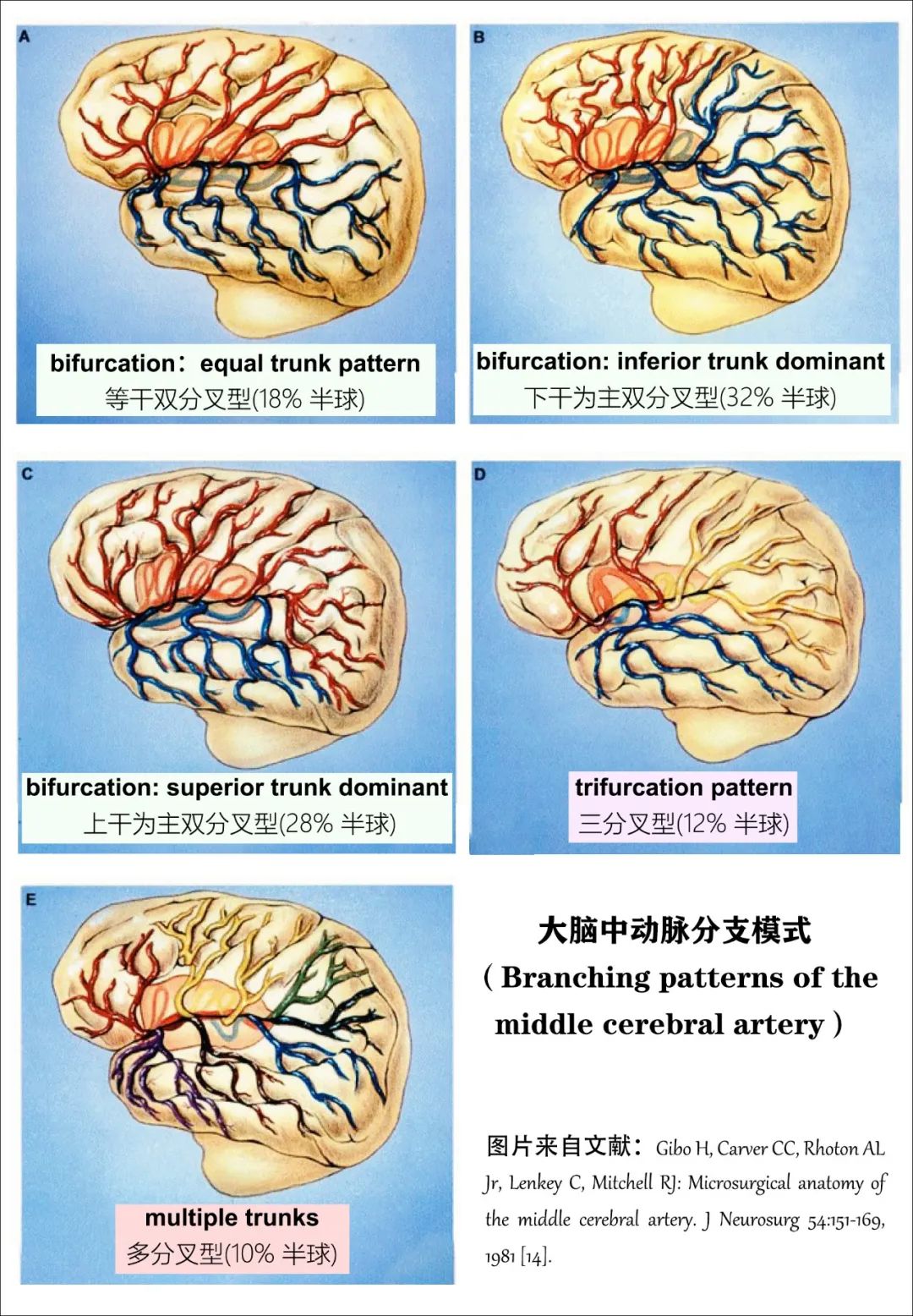 影像PPT - 大脑中动脉解剖-22 影像PPT - 大脑中动脉解剖-22