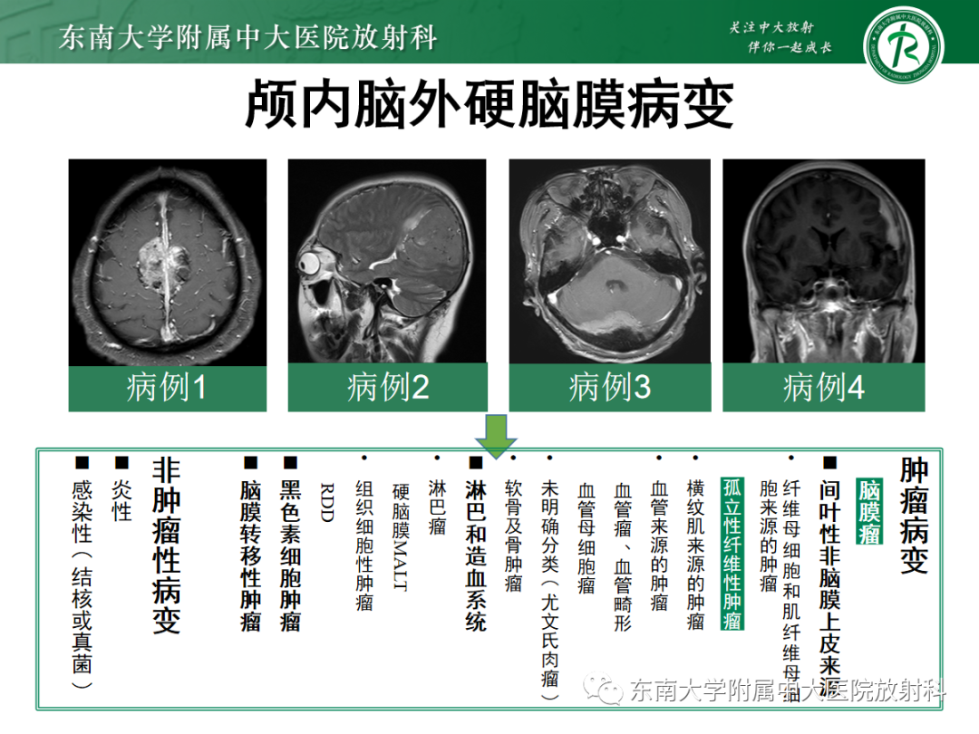 影像PPT - 【PPT】硬脑膜肿瘤性病变影像征象及鉴别诊断分析-12