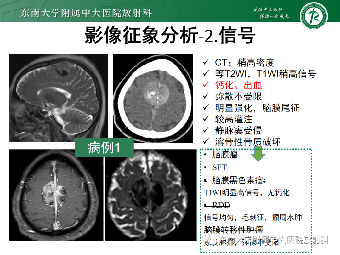 影像PPT - 【PPT】硬脑膜肿瘤性病变影像征象及鉴别诊断分析-14