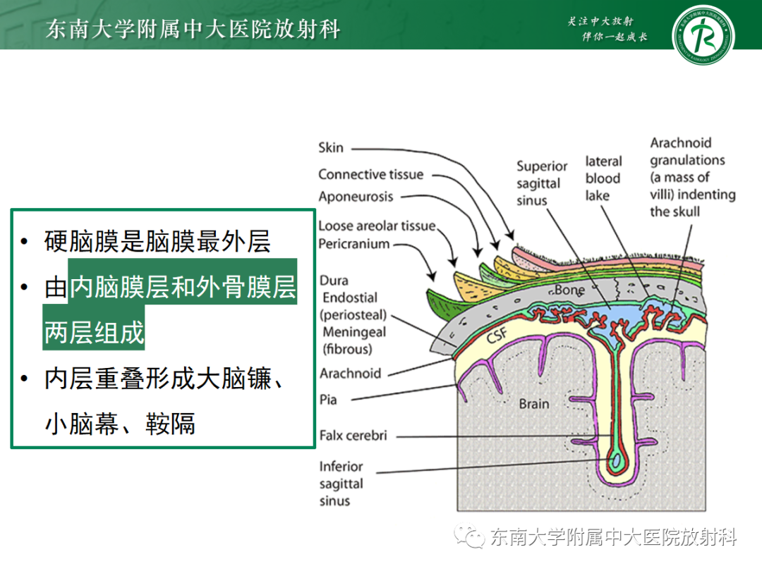 影像PPT - 【PPT】硬脑膜肿瘤性病变影像征象及鉴别诊断分析-22