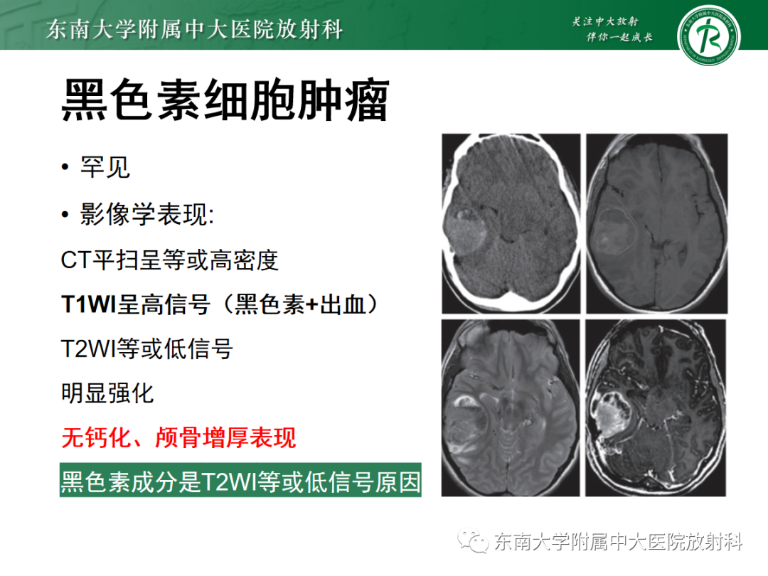 影像PPT - 【PPT】硬脑膜肿瘤性病变影像征象及鉴别诊断分析-37