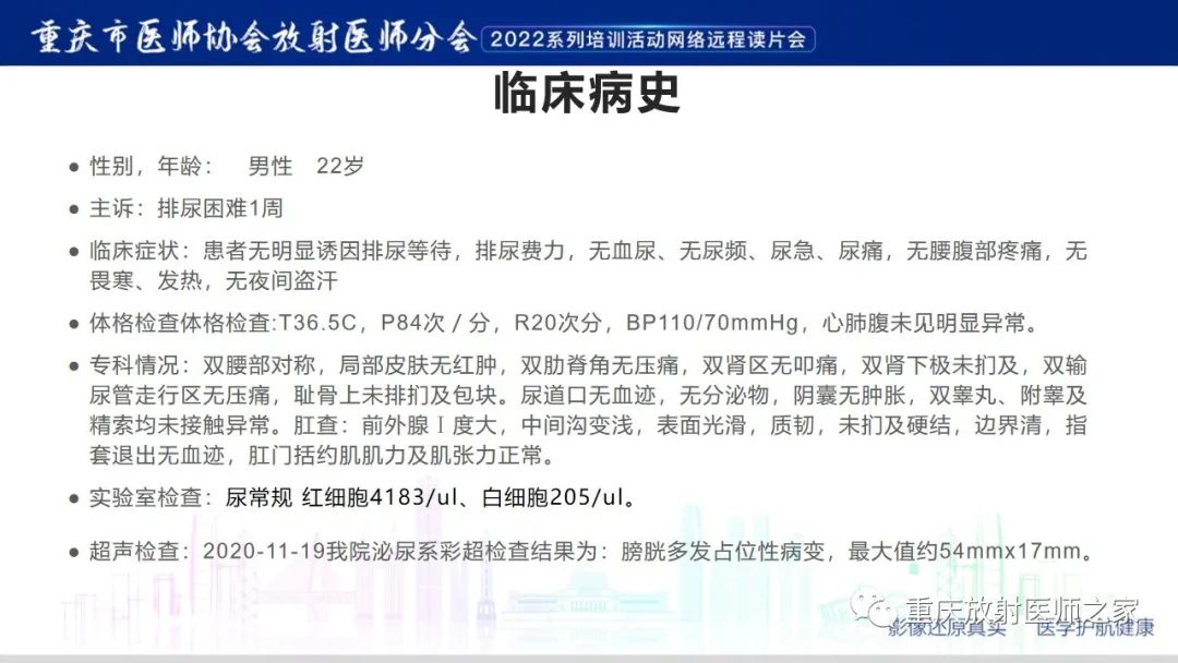 影像PPT - 【病例】腺性膀胱炎1例CT影像-2