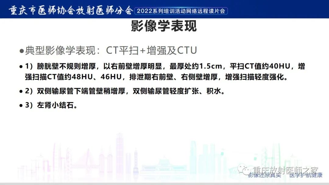 影像PPT - 【病例】腺性膀胱炎1例CT影像-7