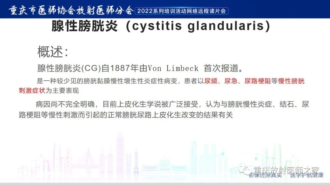 影像PPT - 【病例】腺性膀胱炎1例CT影像-10