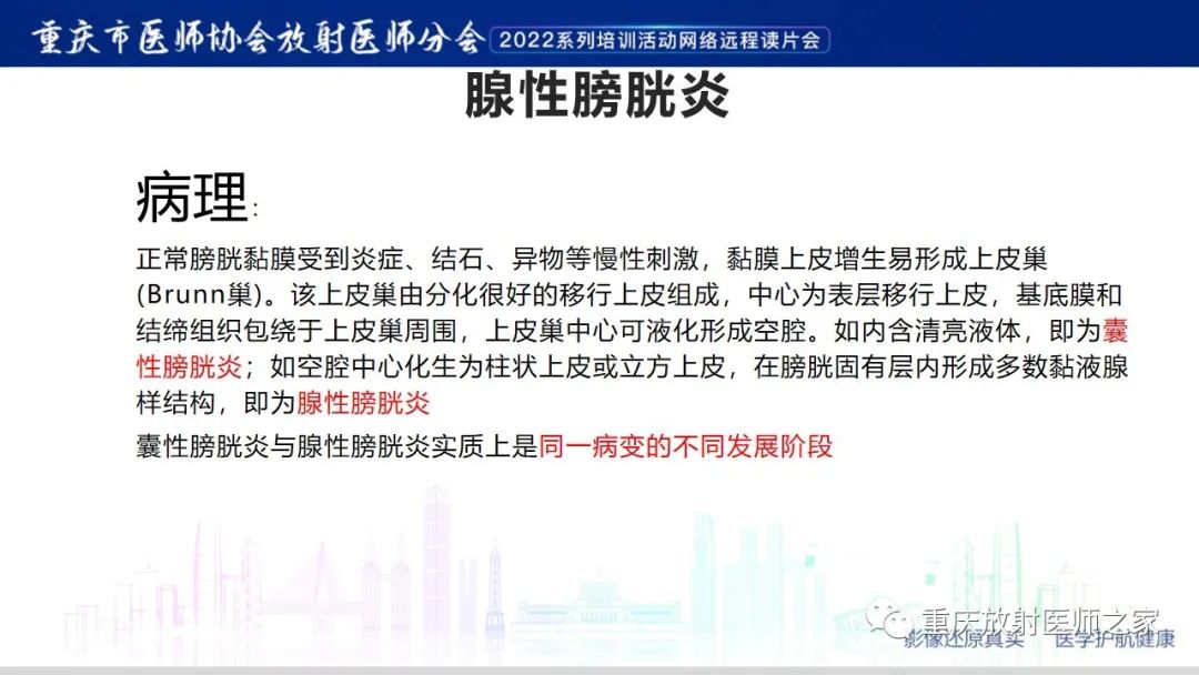 影像PPT - 【病例】腺性膀胱炎1例CT影像-11