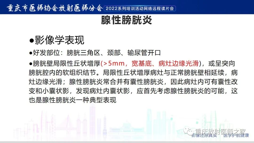 影像PPT - 【病例】腺性膀胱炎1例CT影像-15