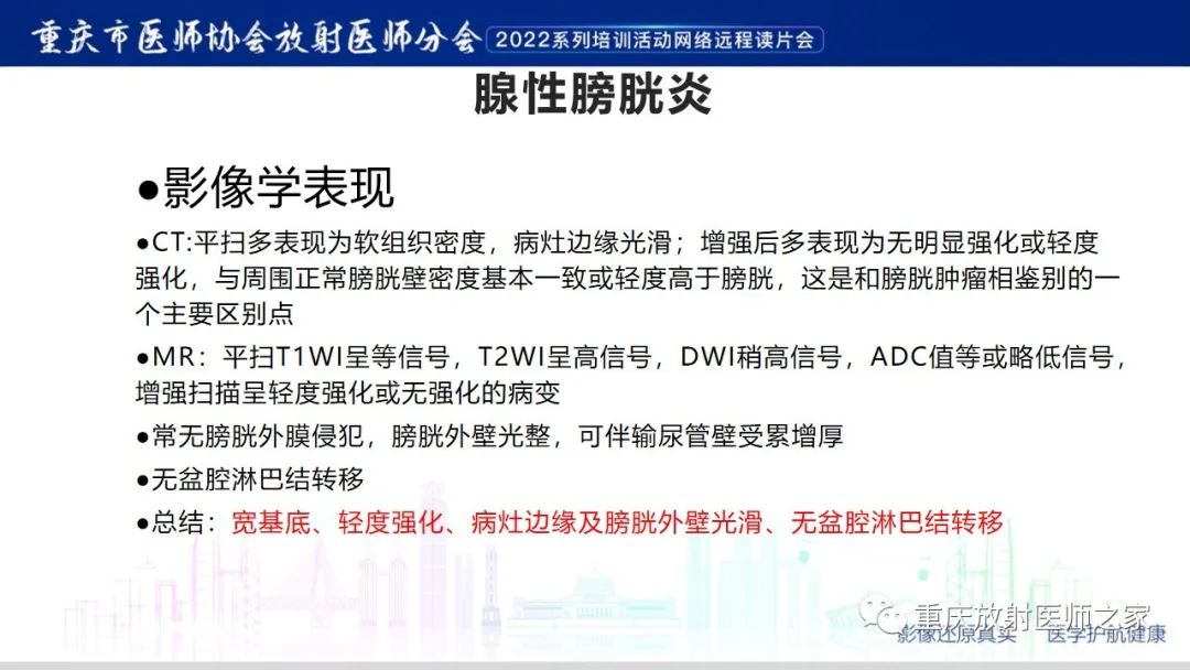 影像PPT - 【病例】腺性膀胱炎1例CT影像-16