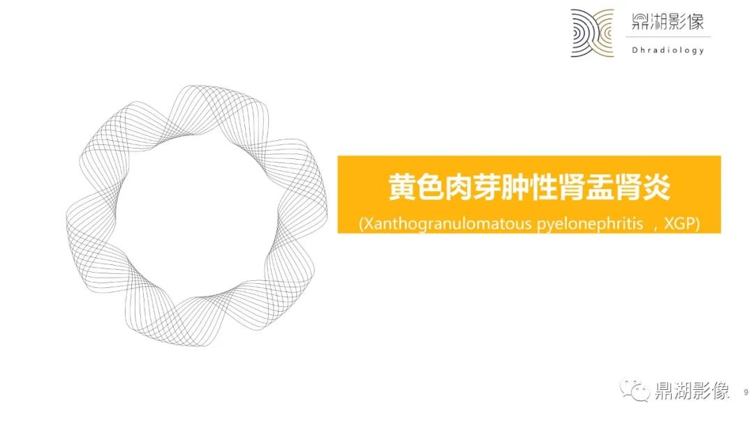 影像PPT - 【PPT】黄色肉芽肿性肾盂肾炎-9 影像PPT - 【PPT】黄色肉芽肿性肾盂肾炎-9